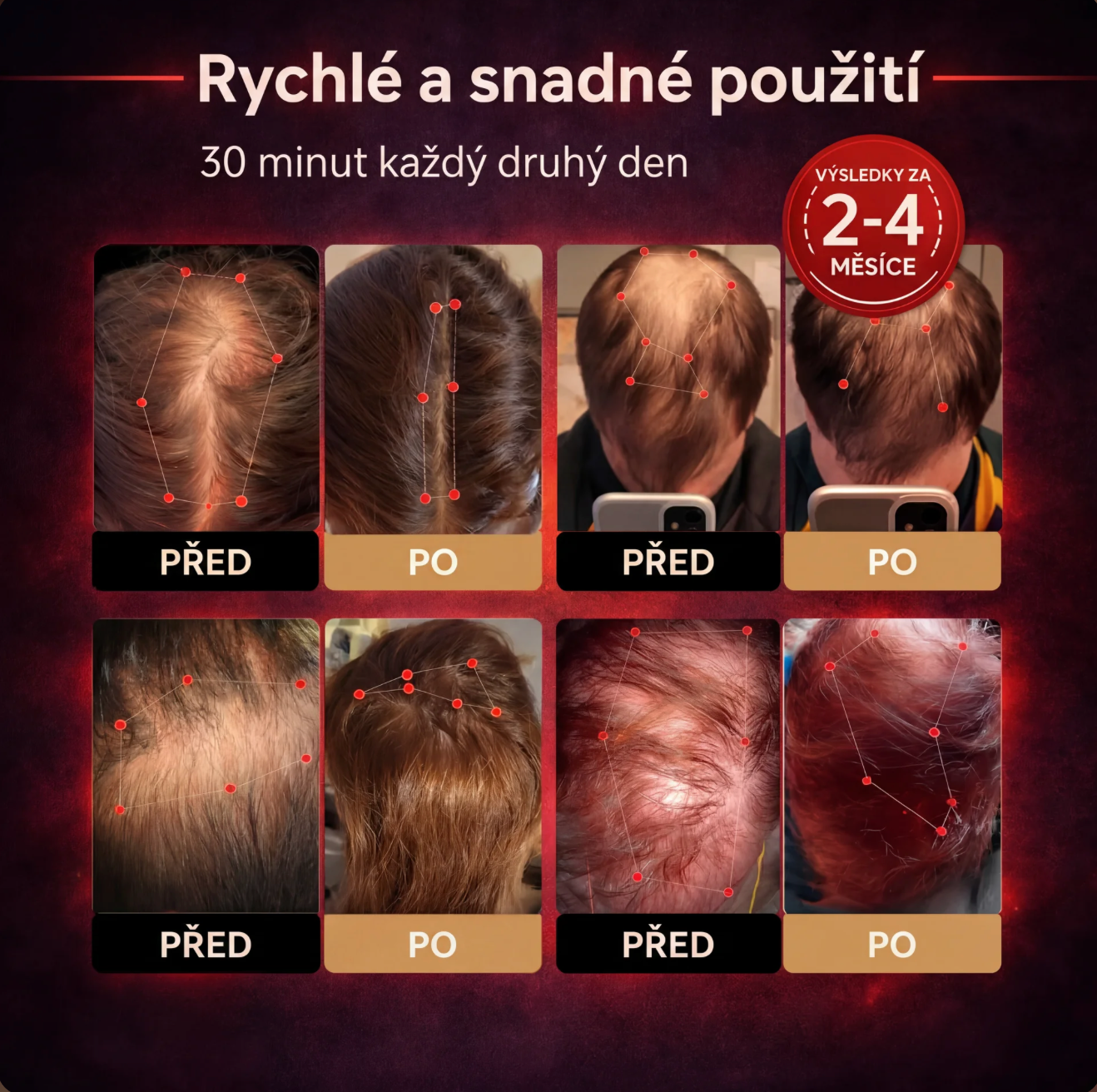 Vlasovna Čepice pro růst vlasů