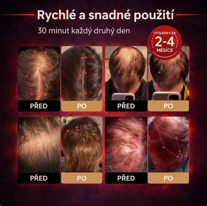 Vlasovna Čepice pro růst vlasů